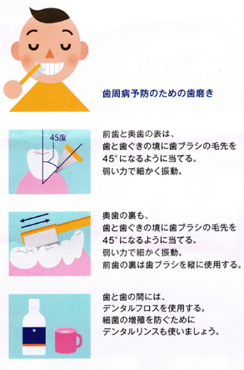 歯周病予防のための歯磨き